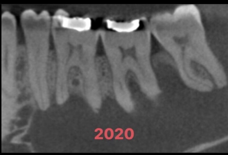 Referring Dentists / Blog Leawood Commons Endodontics